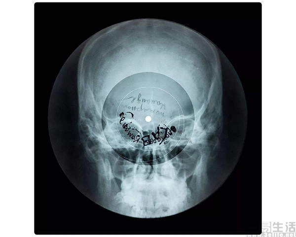 Xray.jpg