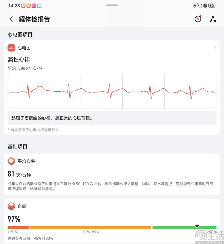 荣耀手表 5 Ultra评测：有“钛”度的高端健康表